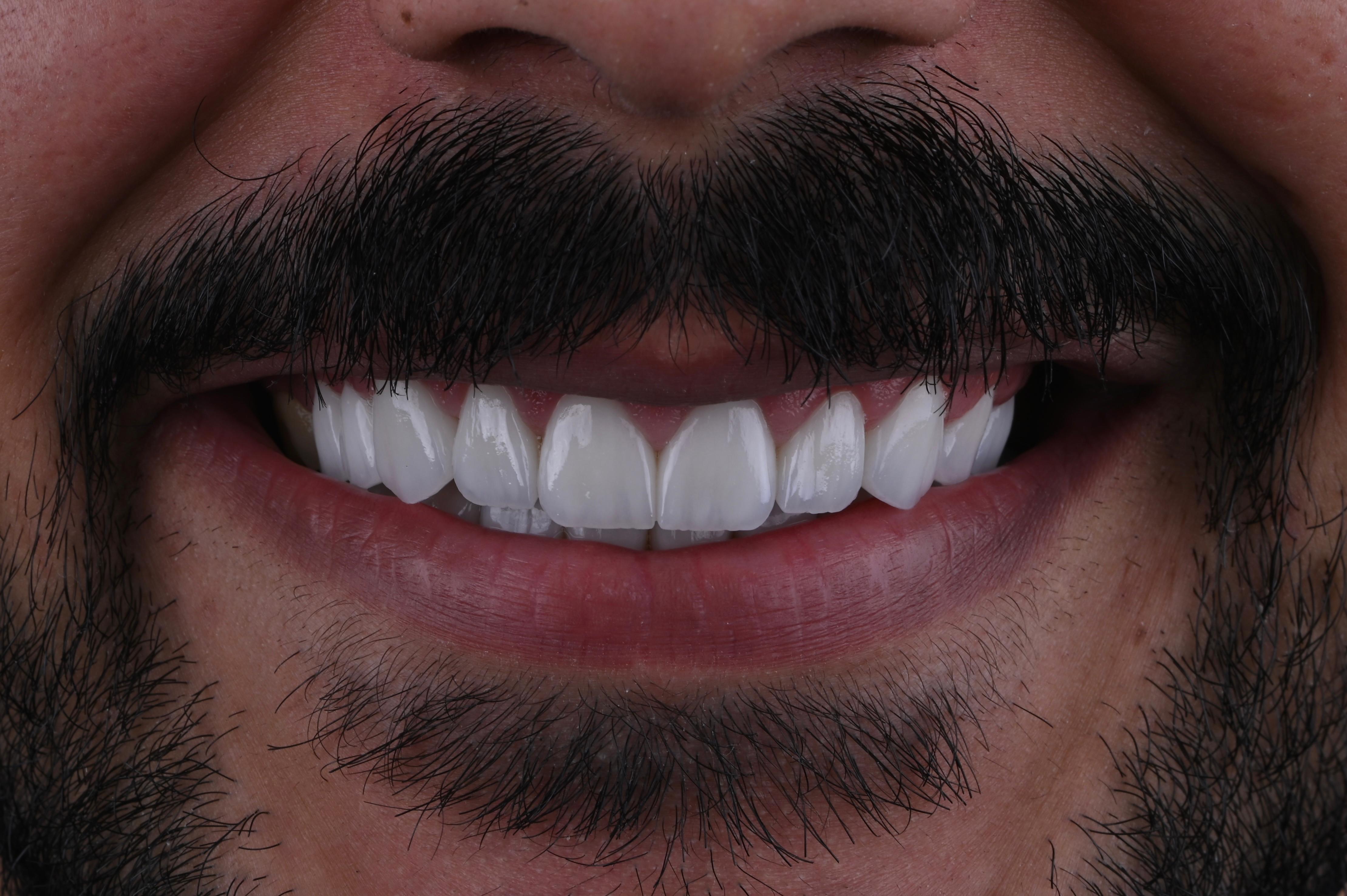 تحميل فوري - نفس اليوم - بعد